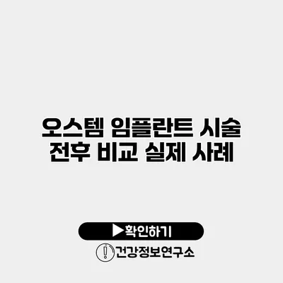 오스템 임플란트 시술 전후 비교 실제 사례